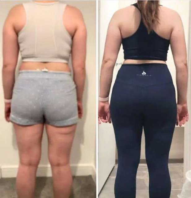 Becky before and after