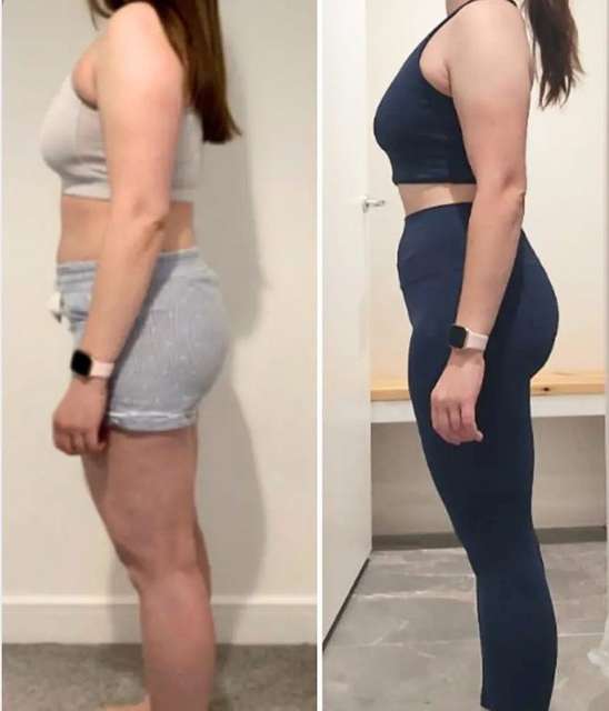 Becky before and after