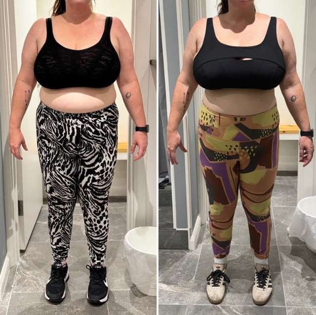 Danni before and after