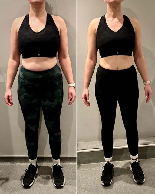 Suzy before and after